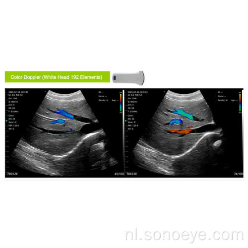 Mini Sono Draadloze draagbare convex 128E